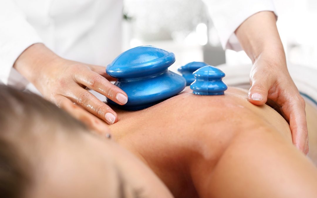 Cupping therapy